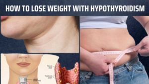 Thyroid Troubles? Here's How to Lose Weight with Hypothyroidism